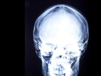 Res_4008855_skull_brain_memory